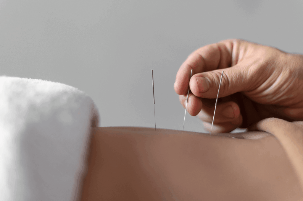 Fertility Acupuncture In Supporting Your Path to Parenthood