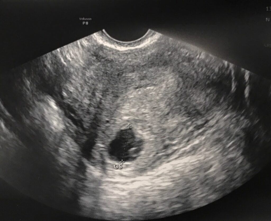 HRC Fertility gallery photo