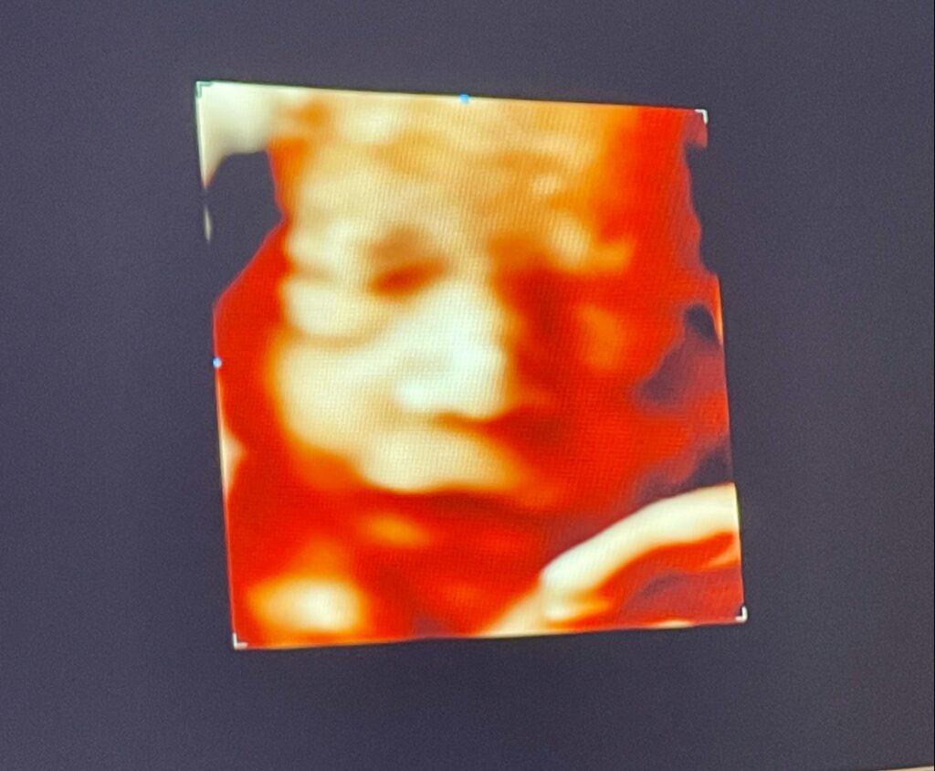 New Leaders in Fertility & Endocrinology, LLC gallery photo