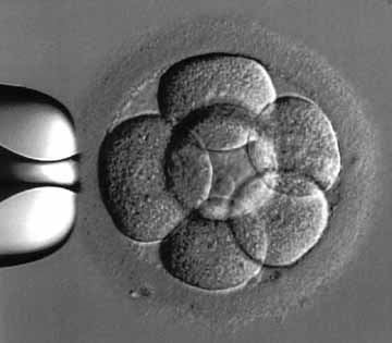Bay IVF Center gallery photo