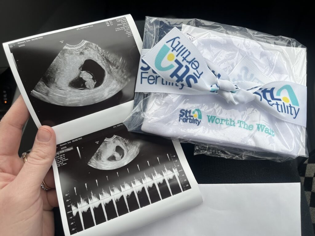 STL Fertility gallery photo
