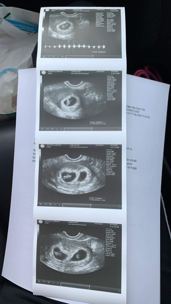 California IVF Fertility Center gallery photo
