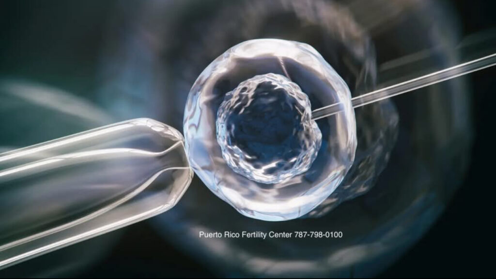 Pedro J. Beauchamp, MD IVF Program dba, Puerto Rico Fertility Center gallery photo