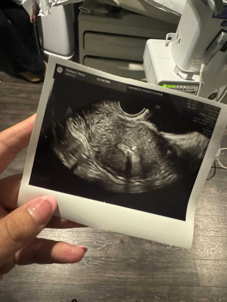 Giving Tree Surrogacy gallery photo