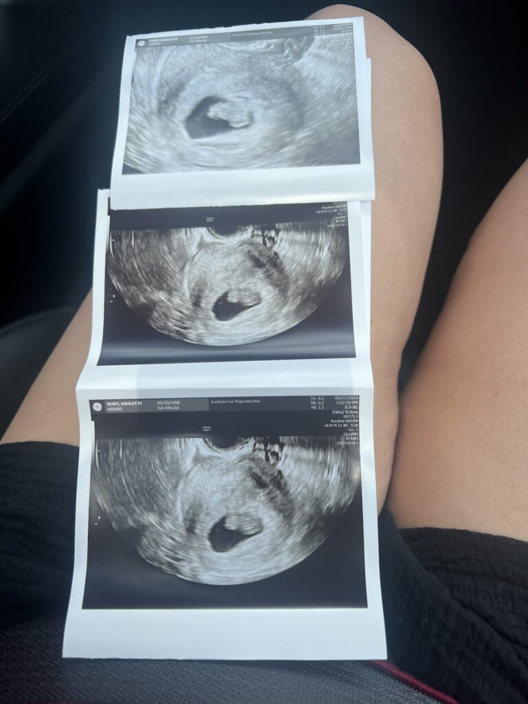 Institute for Reproductive Health | Cincinnati Fertility gallery photo