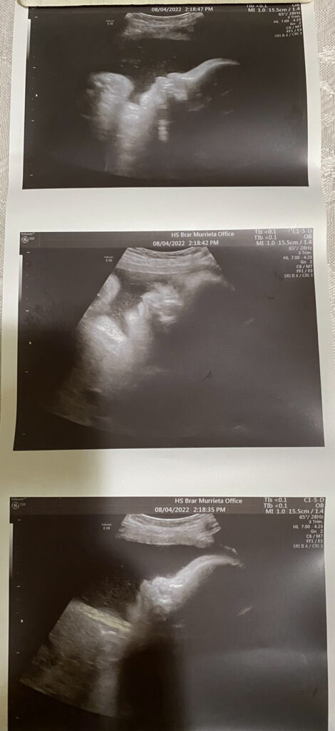 Happy Future Surrogacy gallery photo