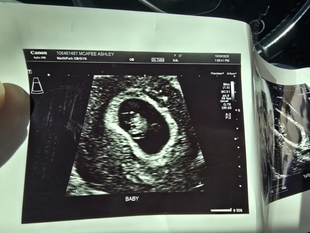 Precision IVF | Frisco | Sushila Arya, MD Fertility Specialist gallery photo