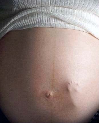 Surrogate Mothers, Inc. gallery photo