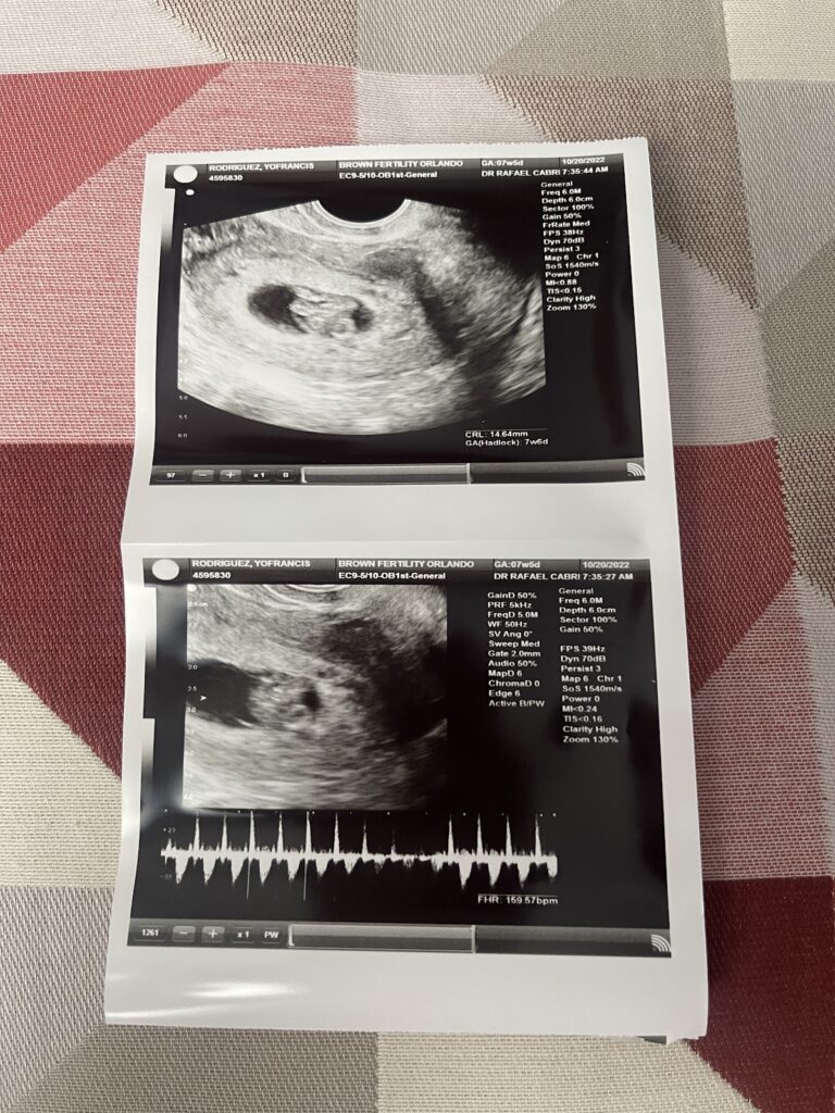 Brown Fertility gallery photo