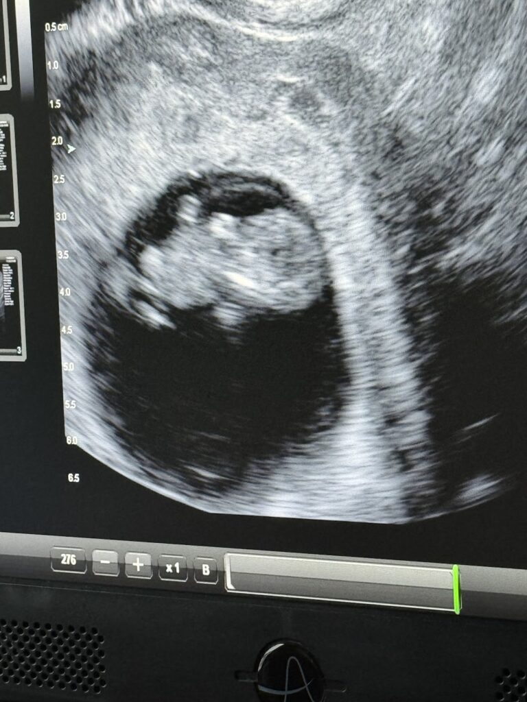 Aspire Fertility – Kingwood gallery photo