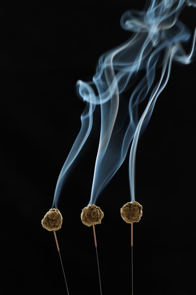 The Wholesome Lotus Fertility Acupuncture gallery photo